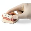 Disposable Micro Tray Impression Trays Practicon 50-Count Box-3