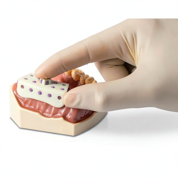 Disposable Micro Tray Impression Trays Practicon 50-Count Box-3